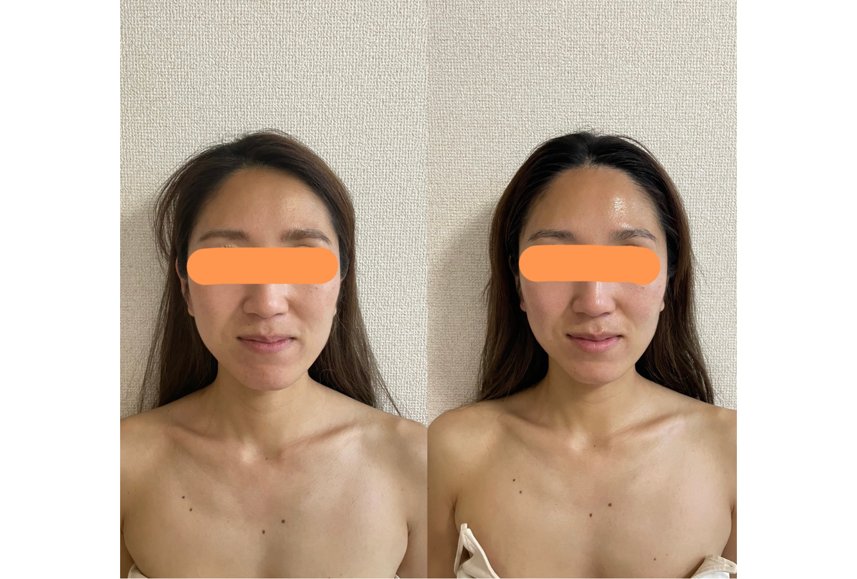 女性